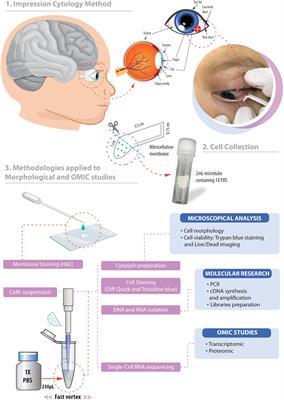 Impression Cytology Is a Non-invasive and Effective Method for Ocular Cell Retrieval of Zika Infected Babies: Perspectives in OMIC Studies